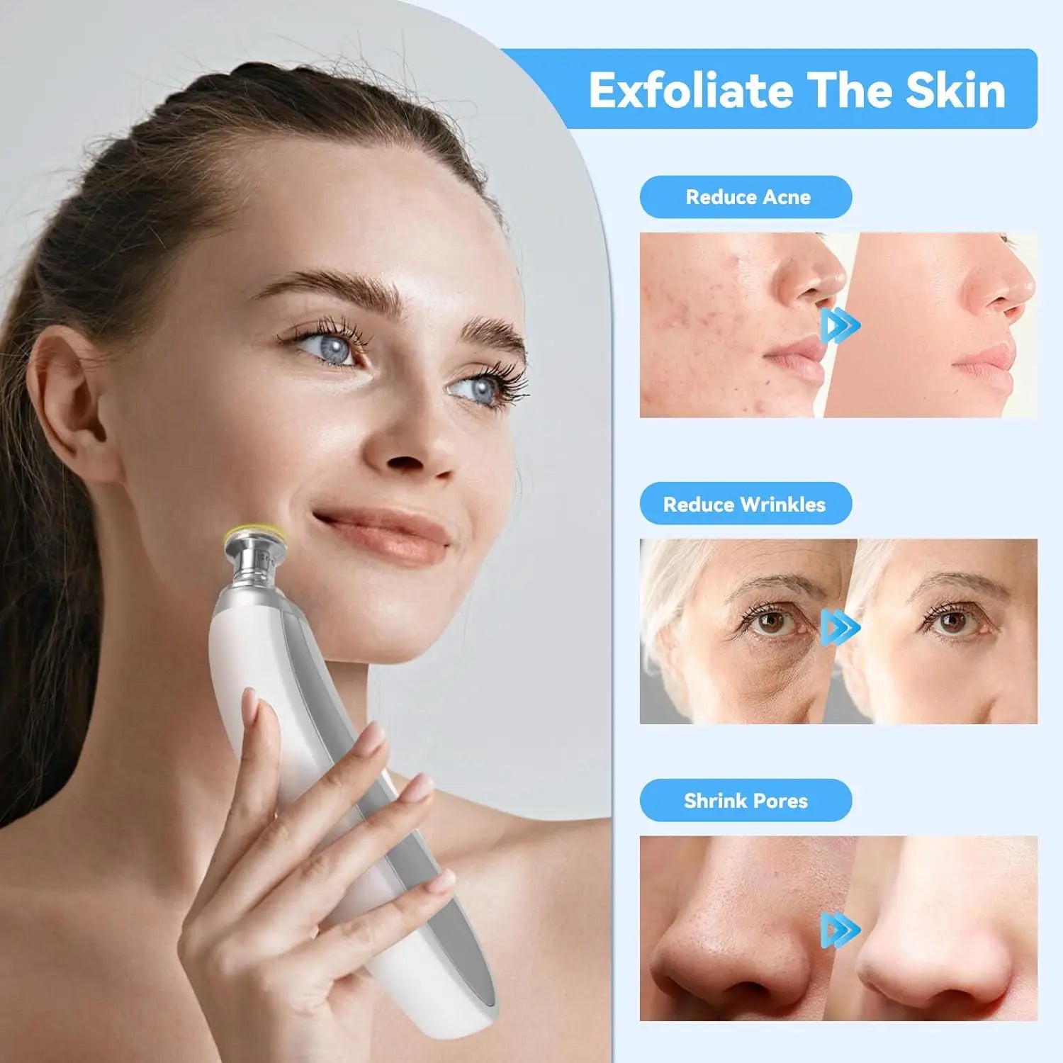 Upgraded Diamond Microdermabrasion Machine White