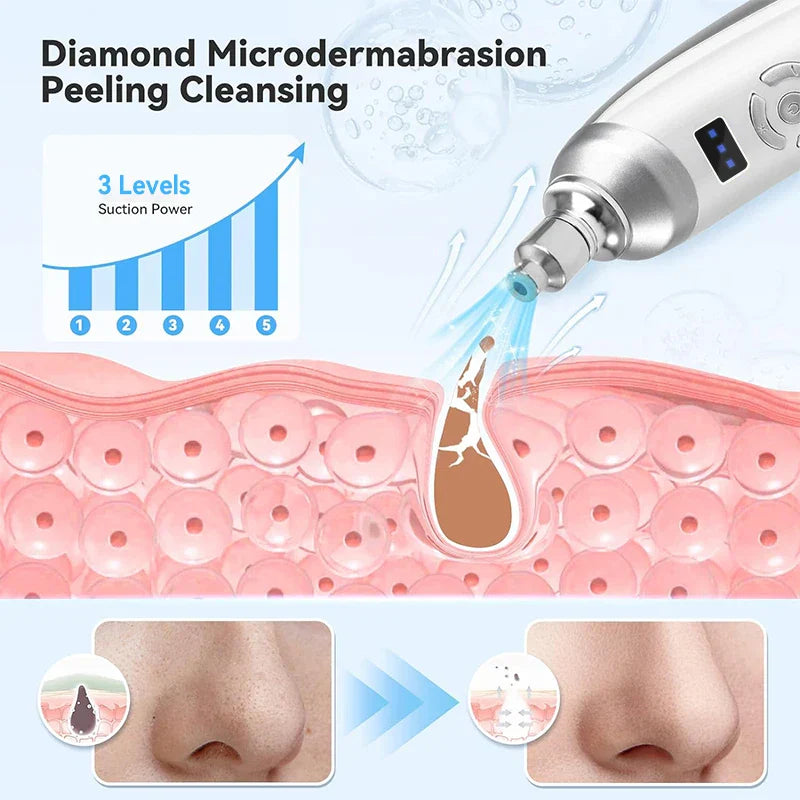 Upgraded Diamond Microdermabrasion Machine White